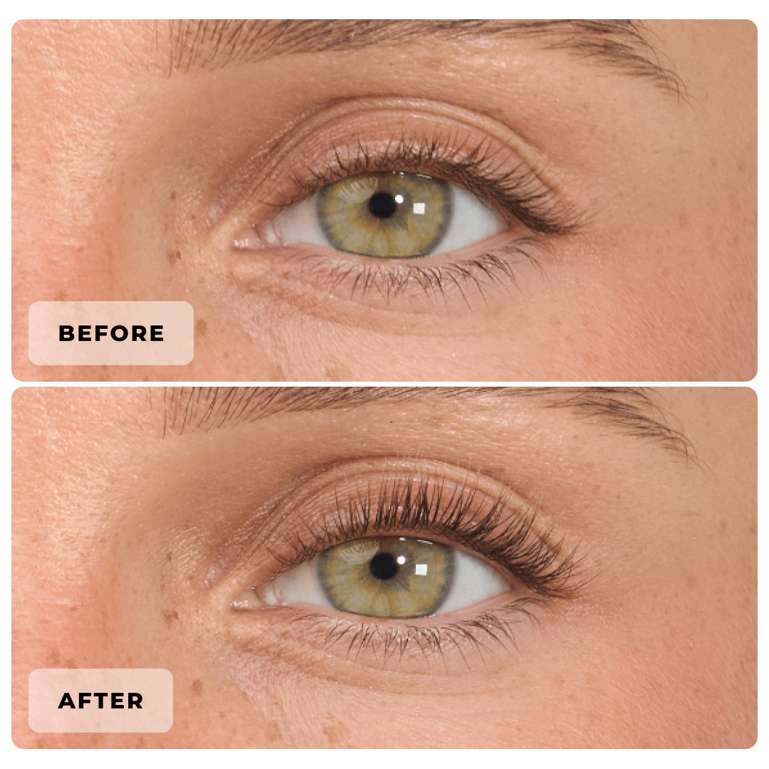 Eyelash Curler